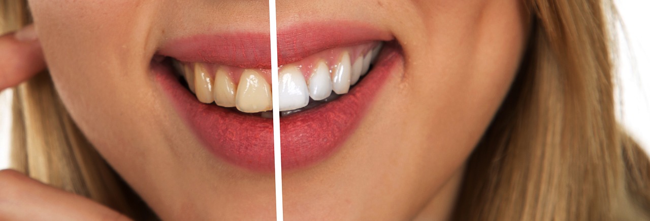Dazzling White Teeth Headquarters Dazzling White Teeth Hq