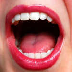 What is Carbamide Peroxide?